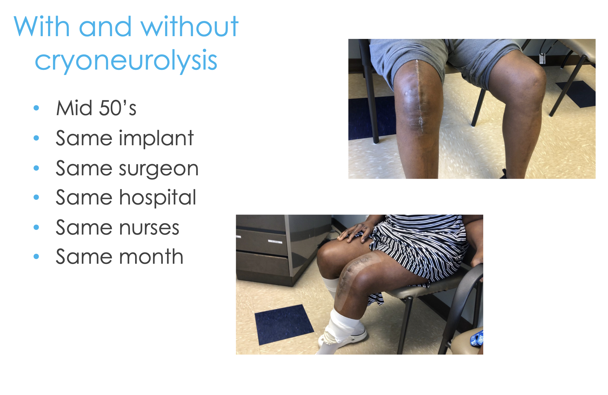 Reducing Post-Operative Pain from Knee Replacement